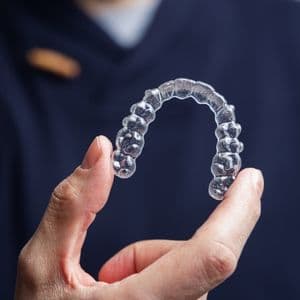 Invisalign Aligners — dental specialist in Rajkot, Gujarat