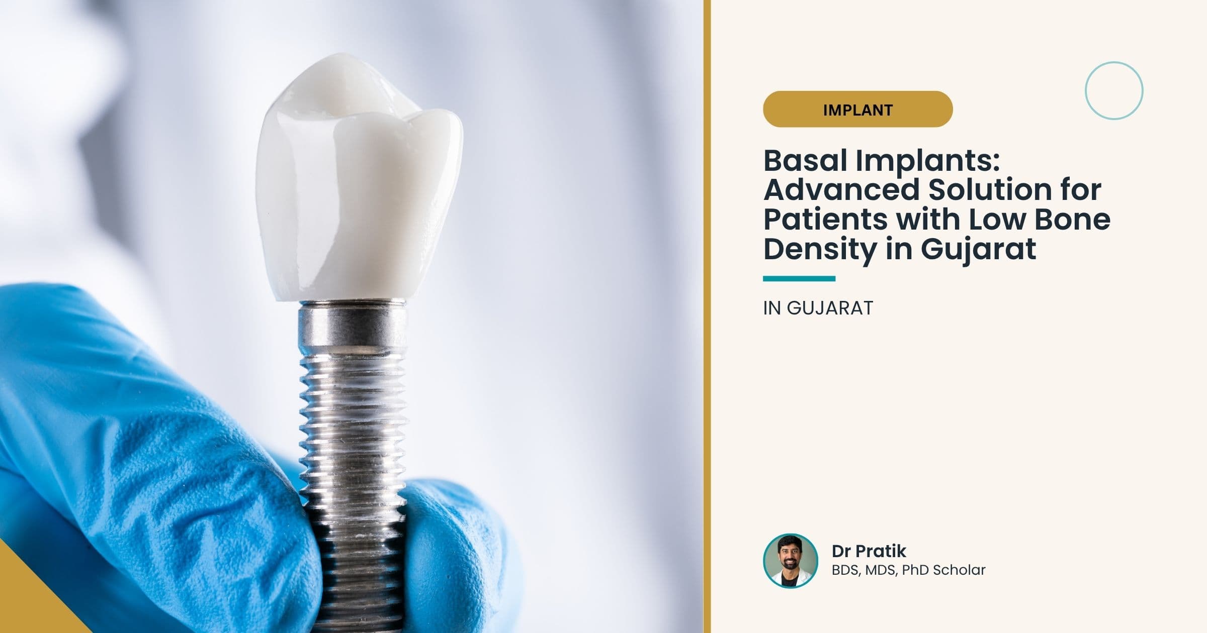 Basal Implants: Advanced Solution for Patients with Low Bone Density in Gujarat