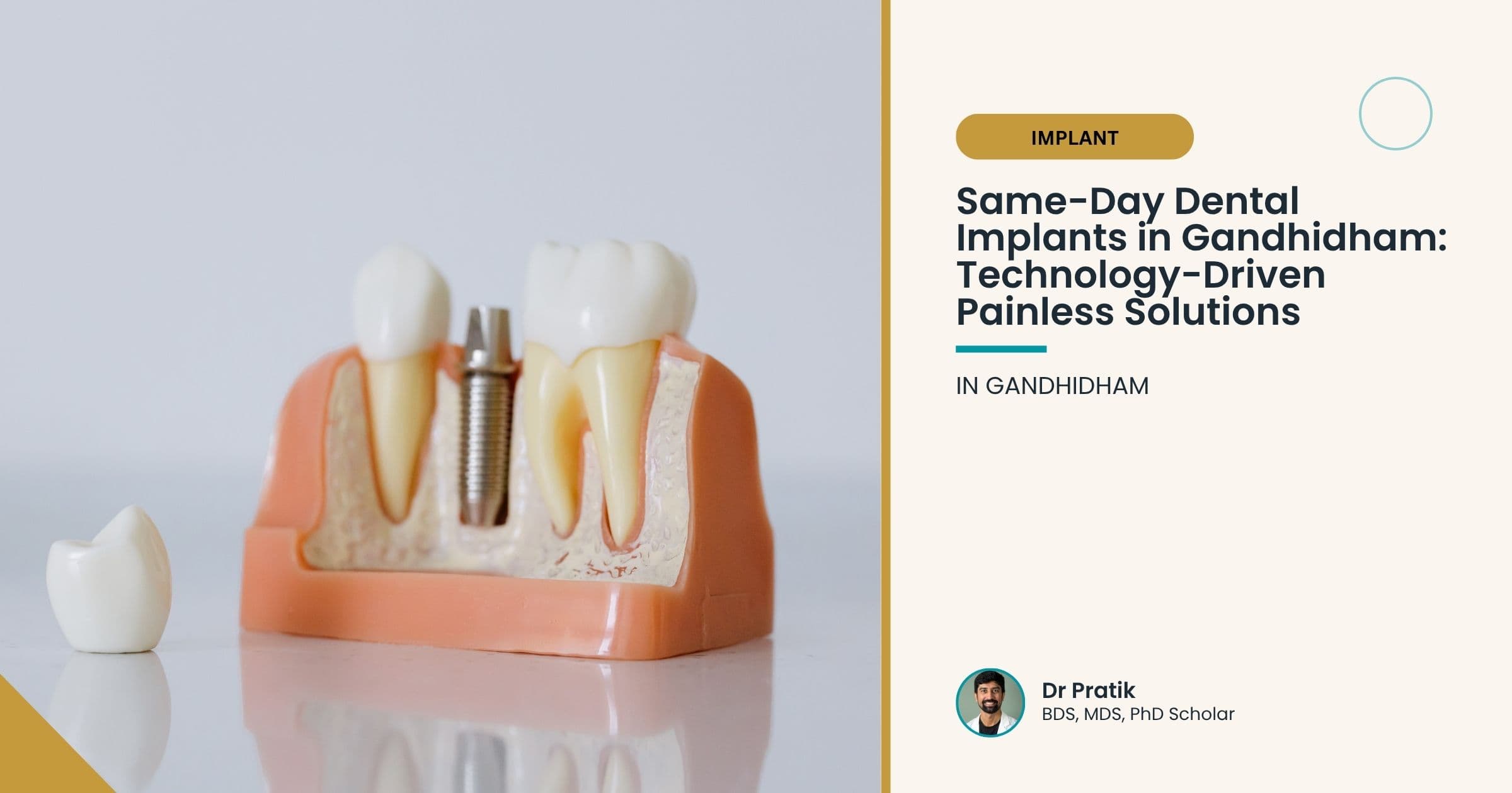 Same-Day Dental Implants in Gandhidham: Technology-Driven Painless Solutions