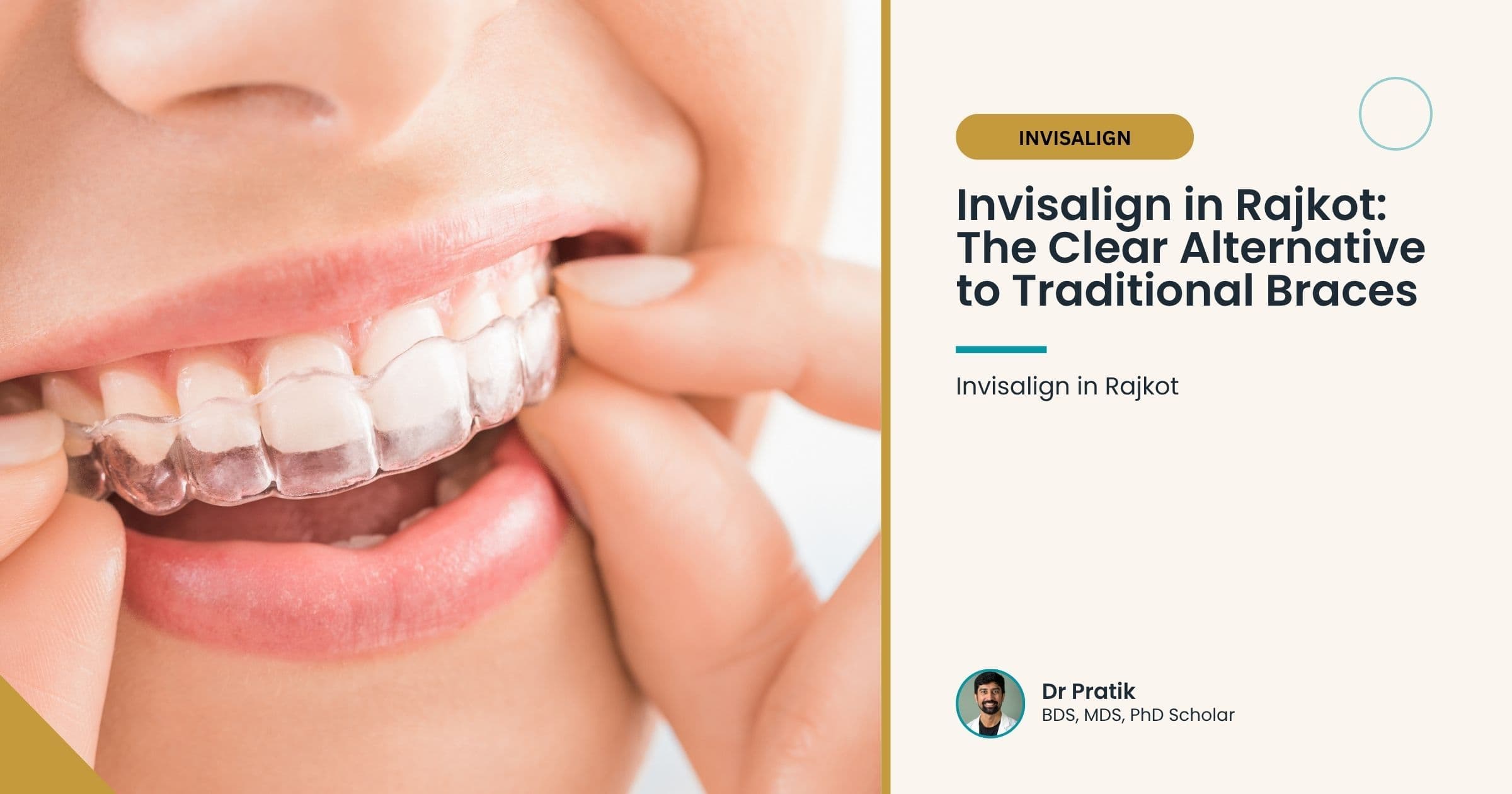Invisalign in Rajkot: The Clear Alternative to Traditional Braces